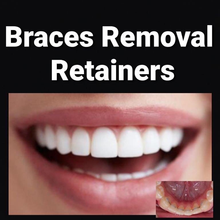 braces remove